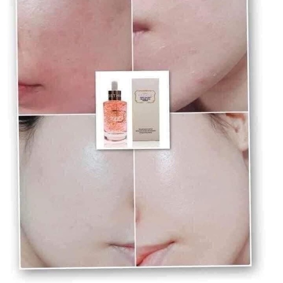 Coreana ORTHIA Perfect collagen 24 Rose Gold Essence 50ml - Picture 10 of 14